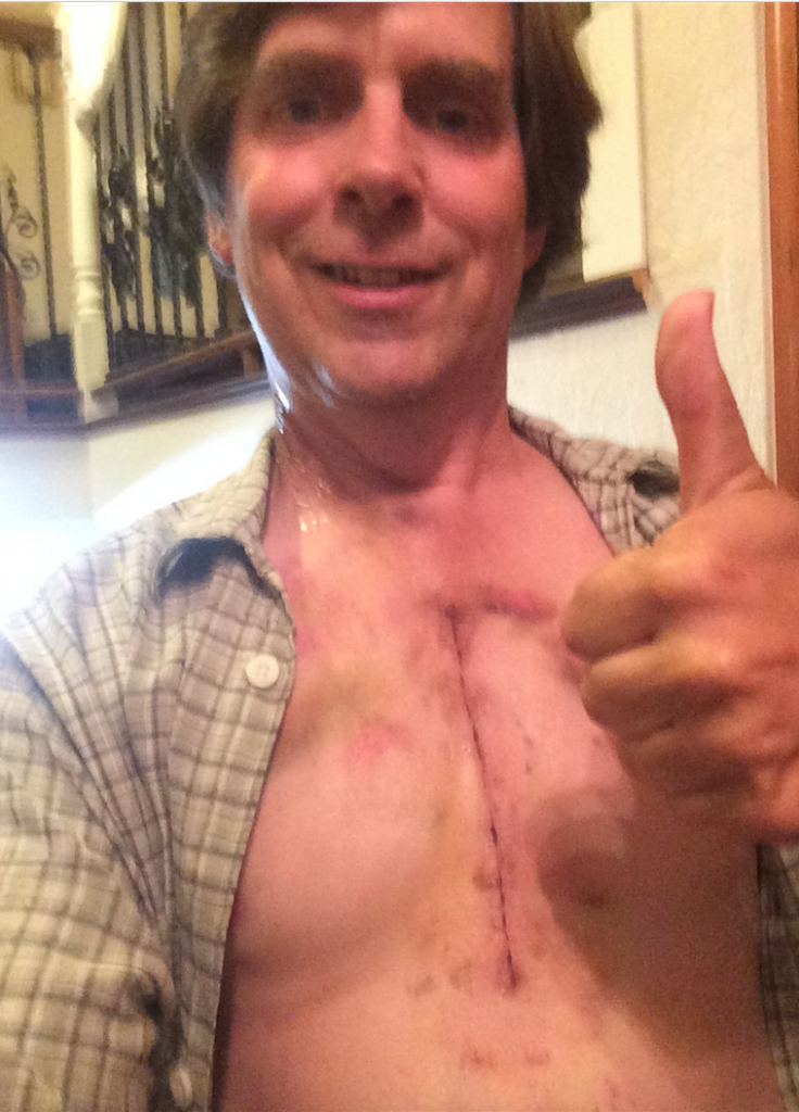 What having your chest cut in half with a circular saw looks like.